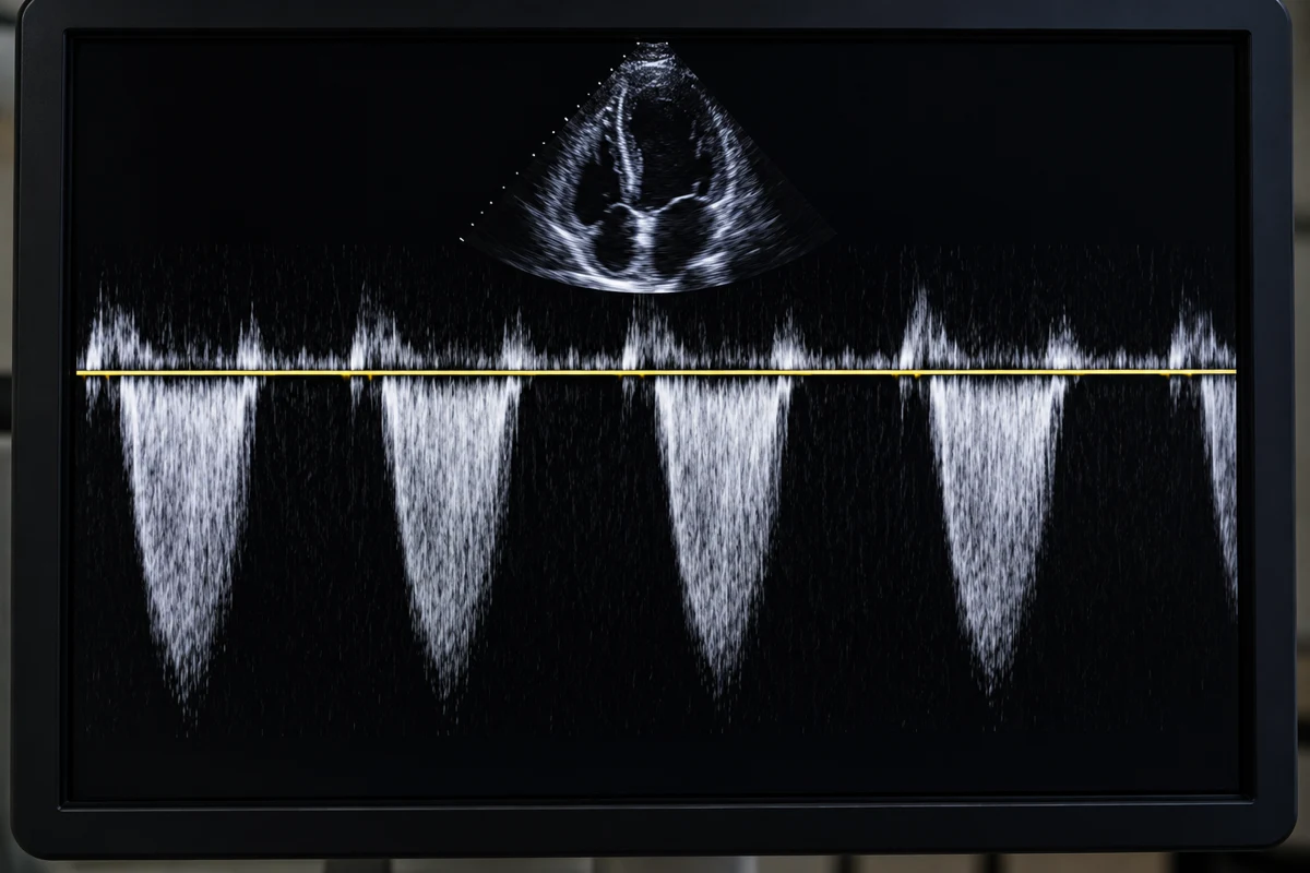 Illustrative continuous-wave Doppler display