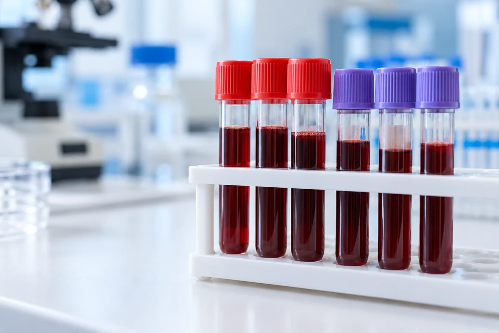 Illustrative blood sample tubes