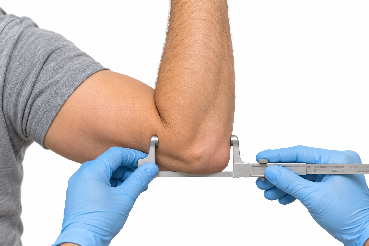 Illustrative elbow breadth measurement using a sliding caliper